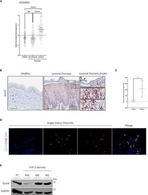 Granzyme K mediates IL-23-dependent inflammation and keratinocyte proliferation in psoriasis